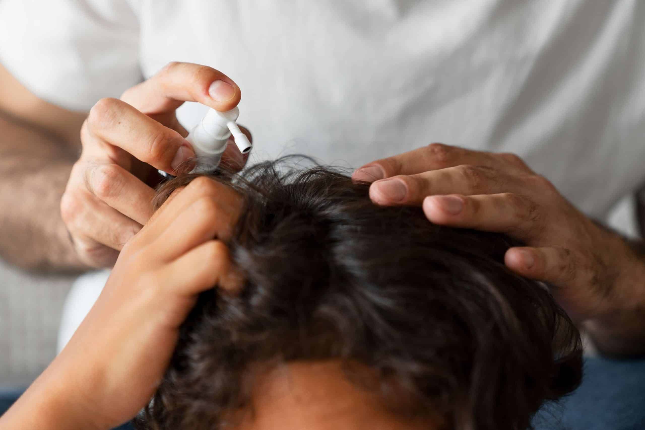can i use coconut oil to get rid of dandruff