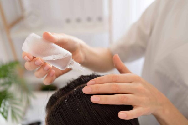 A Complete Guide of Using Virgin Coconut Oil for Dry Scalp A Complete Guide of Using Virgin Coconut Oil for Dry Scalp
