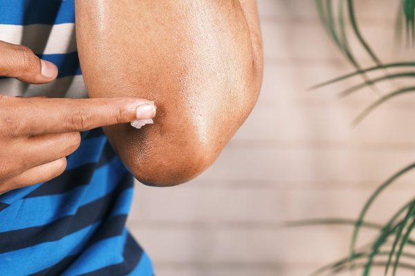Virgin Coconut Oil for Wound, Accelerating Wound Recovery! Virgin Coconut Oil for Wound, Accelerating Wound Recovery!