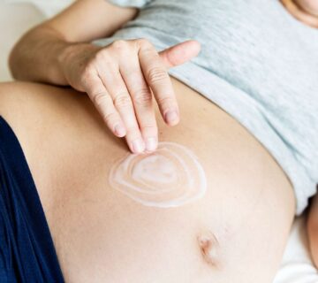 How to Use Virgin Coconut Oil for Stretch Marks