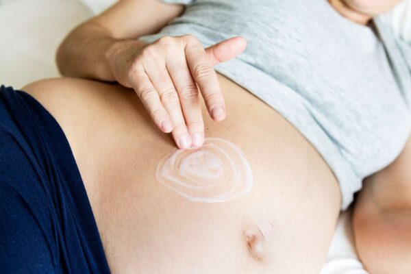 How to Use Virgin Coconut Oil for Stretch Marks How to Use Virgin Coconut Oil for Stretch Marks